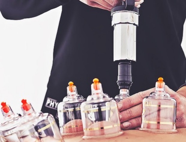 Terapi Bekam/ Foto: Instagram.com/physioldn manfaat bekam di antaranya dapat mengatasi kongesti dan asma