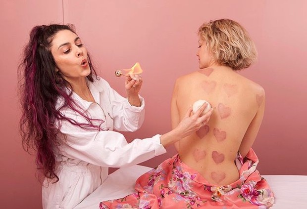 Terapi Bekam/ Foto: Instagram.com/lovecupping manfaat bekam di antaranya dapat mengurangi bekas luka dan stretch mark