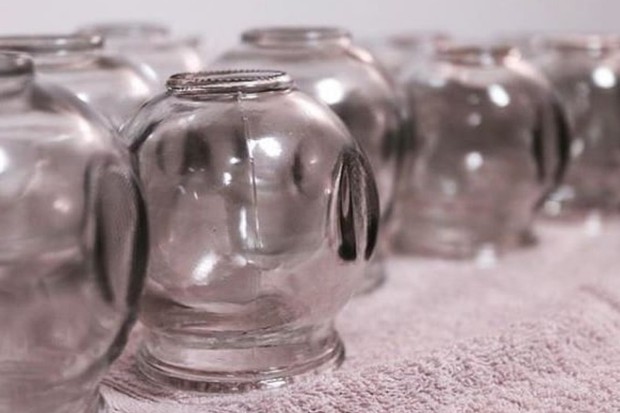 Terapi Bekam/ Foto: instagram.com/thequeentotalbeauty manfaat bekam, terapi yang menggunakan cup, dapat melepaskan racun dalam tubuh