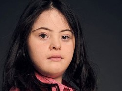 Ambisi Gadis Penyandang Down Syndrome yang Jadi Model Majalah Vogue