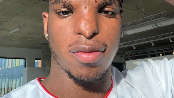 Cowok Ini Nggak Nyangka dengan Bentuk Hidung Begini Bisa Jadi Model