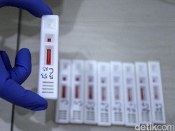Alat Rapid Test Cuma Rp 45 Ribu, Kok Warga Bayar hingga Rp 425 Ribu?