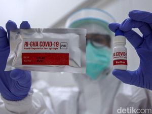 Sensitivitas Rapid Test Corona Buatan Indonesia Diklaim Bisa di Atas 90 Persen