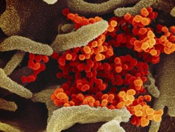 Studi: 80 Persen Pasien Corona di Bawah 20 Tahun adalah OTG