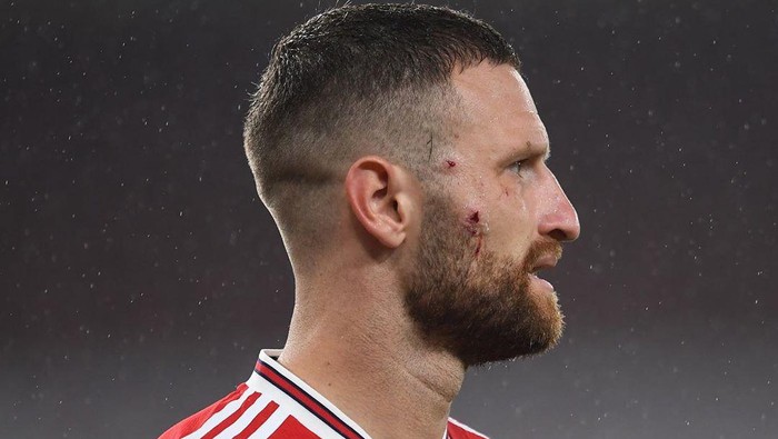 Shkodran Mustafi mendapatkan luka di wajahnya akibat terjangan kaki Jamie Vardy di laga Arsenal vs Leicester yang berlangsung di Emirates Stadium, Rabu (8/7/2020) dini hari WIB.