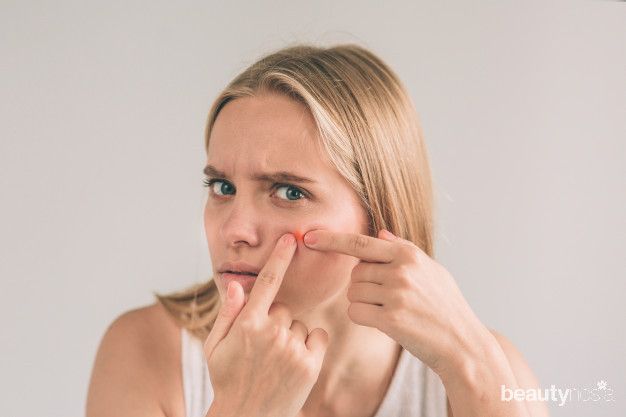 Es batu dapat meredakan jerawat