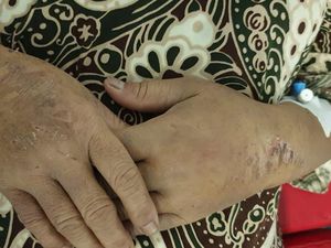 TKI Diduga Disiksa di Arab Saudi, Kini dalam Kondisi Kritis di RS Jeddah TKI Diduga Disiksa di Arab Saudi, Kini dalam Kondisi Kritis di RS Jeddah