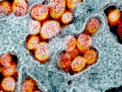 Baru Lagi! COVID-19 Varian Lambda Sudah Menyebar ke 29 Negara