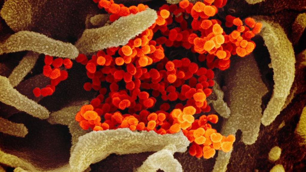 Tampilan Virus Corona di Bawah Mikroskop, Cantik Tapi Bahaya