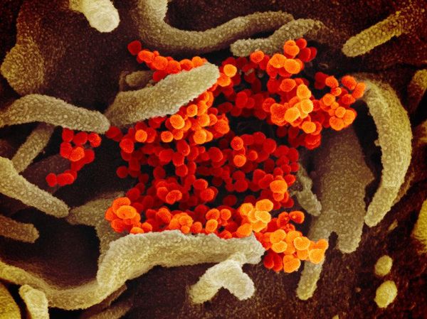 Cantik Tapi Berbahaya, Potret Virus di Bawah Lensa Mikroskop