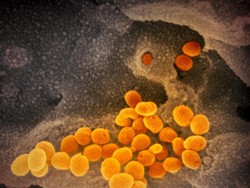 Pakar IDI: Waspada, Corona B117 64 Persen Lebih Berisiko Fatal