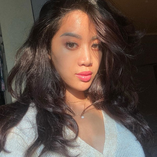 Widi Vierratale/instagram.com/_widikidiw_/ Widi Vierratale tegaskan tak jalani oplas, tapi dengan tanam benang dan filler untuk mendapatkan hidung mancung