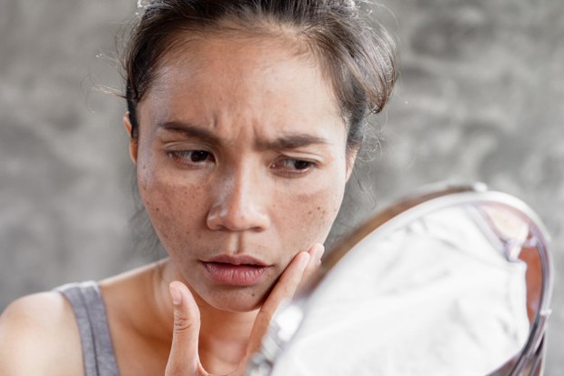 Kulit Menjadi Panas dan Muncul Ruam Merah/Freepik.com Kulit panas dan muncul ruam merah