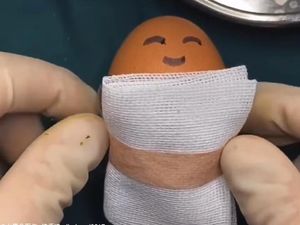 Gabut, Netizen Ini Bedah Isi Telur Ayam Lalu Diperban Seperti Habis Operasi