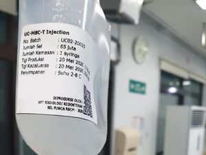 UI-RSCM Uji Klinis Sel Punca untuk Pengobatan Pasien COVID-19