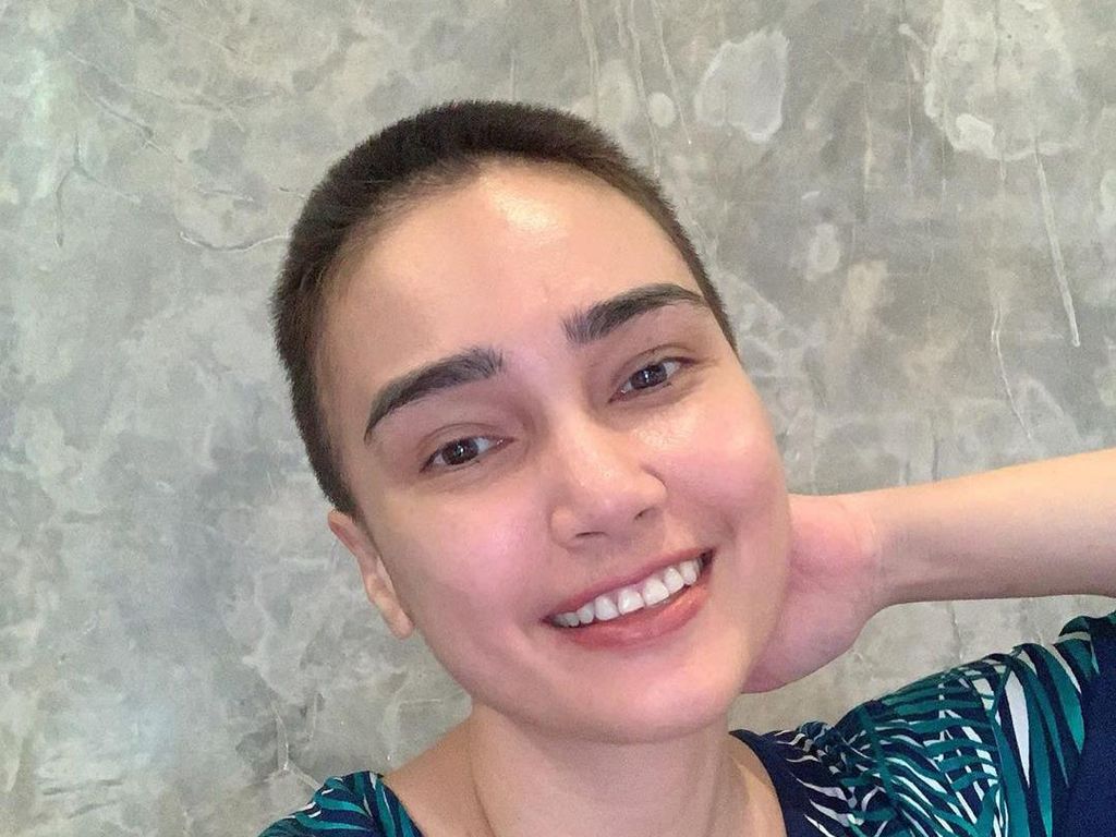 Jalani Kemoterapi, Feby Febiola Bersyukur Banyak yang Menguatkan Jalani Kemoterapi, Feby Febiola Bersyukur Banyak yang Menguatkan