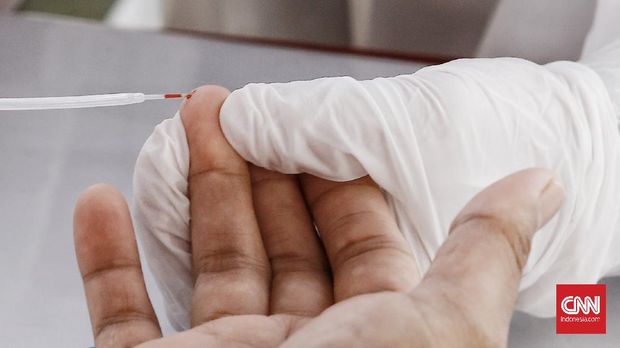 Petugas mengambil sampel darah warga yang mengikuti Mobile Rapid Test (tes bergerak) yang diadakan Relawan Indonesia Bersatu Lawan Covid-19 di Jakarta, Selasa (21/7/2020).  Tes cepat secara massal ini diadakan untuk mendeteksi paparan virus corona di masyarakat, terutama di wilayah-wilayah yang menjadi zona merah COVID-19. CNN Indonesia/Andry Novelino