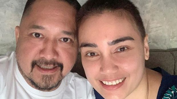 Transformasi Feby Febiola sebelum dan setelah operasi kista ovarium.
