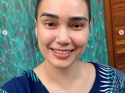 Feby Febiola Idap Kanker, Rambut Panjang Jadi Bondol Tapi Tetap Senyum