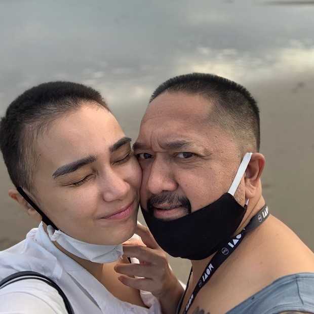 Feby Febiola/instagram.com/febyfebiola_/ Feby Febiola dan Franky Sihombing dengan rambut bondol, nyaris botak