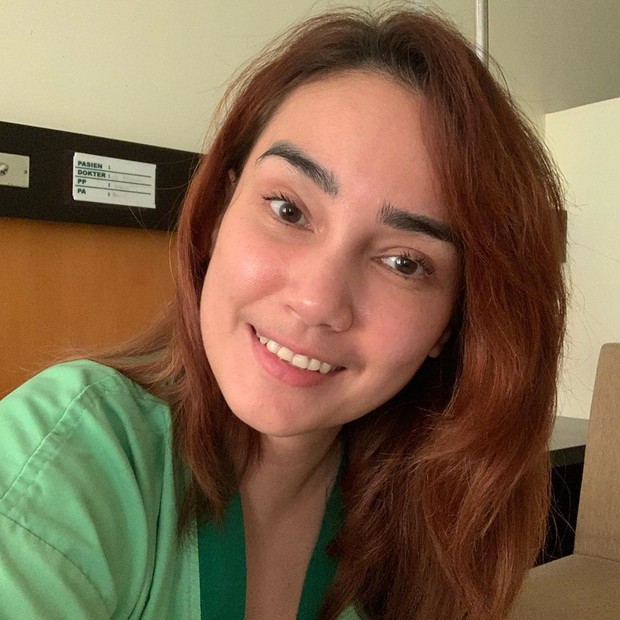 Feby Febiola/instagram.com/febyfebiola_/ Feby Febiola jalani kemoterapi