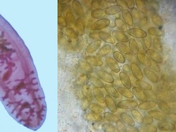 Waduh! Makan Ikan Mentah, Hati Pria Ini Digerogoti Cacing