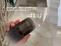 Polri: Kombes Rachmat Widodo Juga Polisikan Anaknya karena Digigit