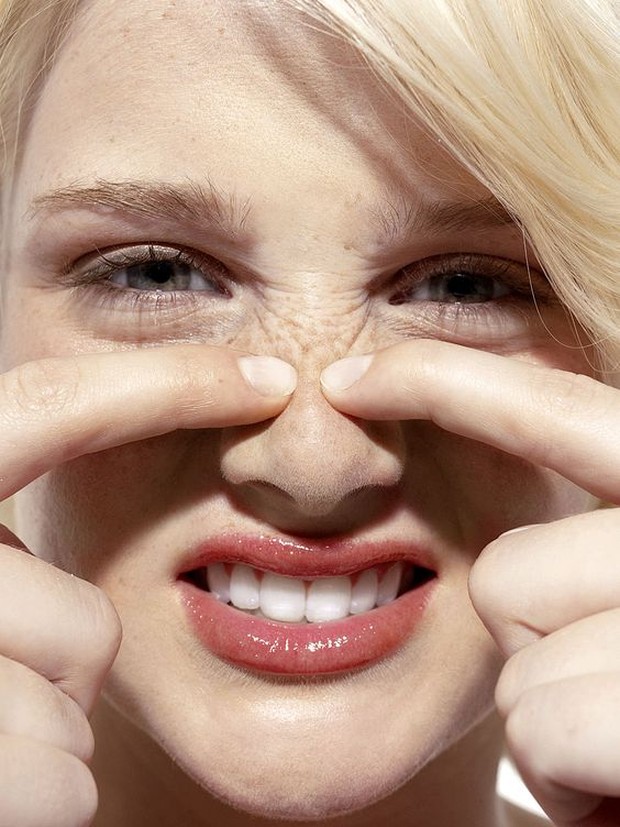 Alergi Kosmetik/pinterest.com Munculnya bercak merah seperti ruam juga salah satu tanda kamu alergi terhadap kosmetik.