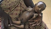 Corona Bikin Anak-anak di Burkina Faso Makin Menderita