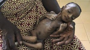 Corona Bikin Anak-anak di Burkina Faso Makin Menderita