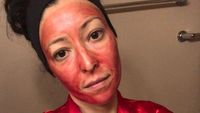 Potret Wanita Gunakan Darah Menstruasi Sebagai Masker, Ngaku Bikin Glowing