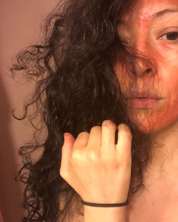 Wanita Ini Punya Ritual Aneh Pakai Darah Haid Untuk Kulit Glowing Beneran