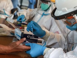 Alasan Rapid Test Tak Bisa Dijadikan Acuan Pemeriksaan Virus Corona