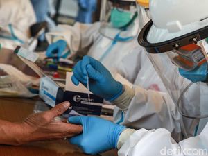 Alasan Rapid Test Tak Bisa Dijadikan Acuan Pemeriksaan Virus Corona Alasan Rapid Test Tak Bisa Dijadikan Acuan Pemeriksaan Virus Corona
