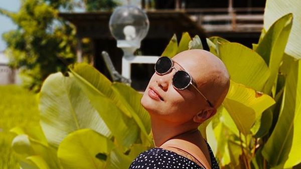 Potret Feby Febiola Cantik dengan Kepala Plontos