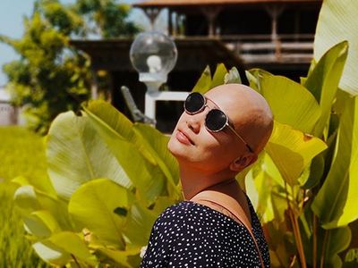 Potret Feby Febiola Cantik dengan Kepala Plontos