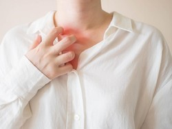 Cuaca Panas Bikin Gampang Biang Keringat, Bagaimana Mengatasinya?