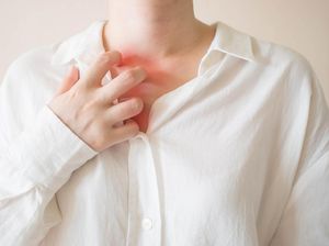 Sering Disepelekan, Gigitan Tungau Bisa Timbulkan Gejala Serius Ini Sering Disepelekan, Gigitan Tungau Bisa Timbulkan Gejala Serius Ini