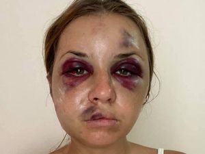 Cerita Pilu Presenter Cantik, Hampir Diperkosa & Dipukuli Sampai Babak Belur