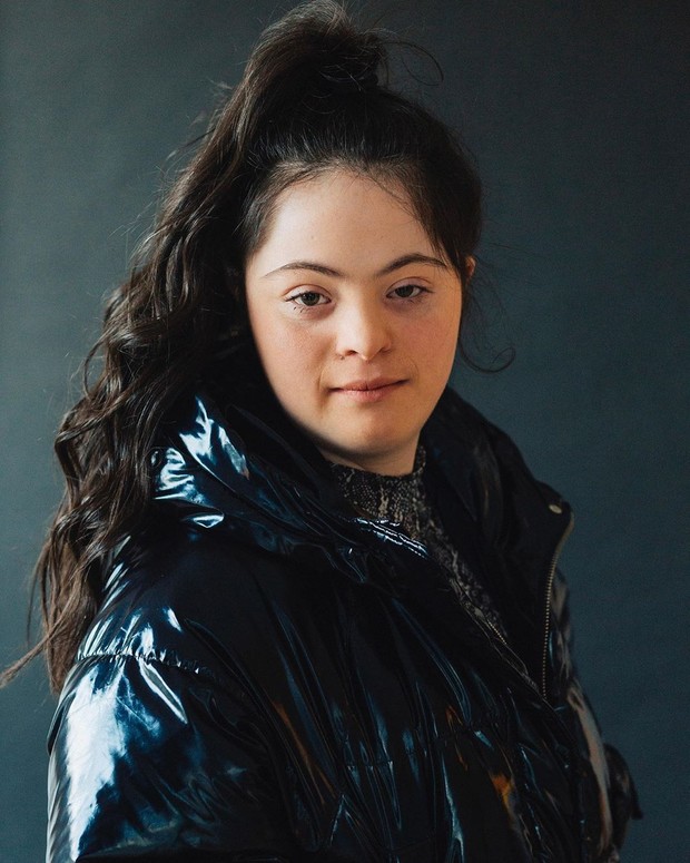 Ellie Goldstein, gadis down syndrome yang jadi model Gucci Beauty.