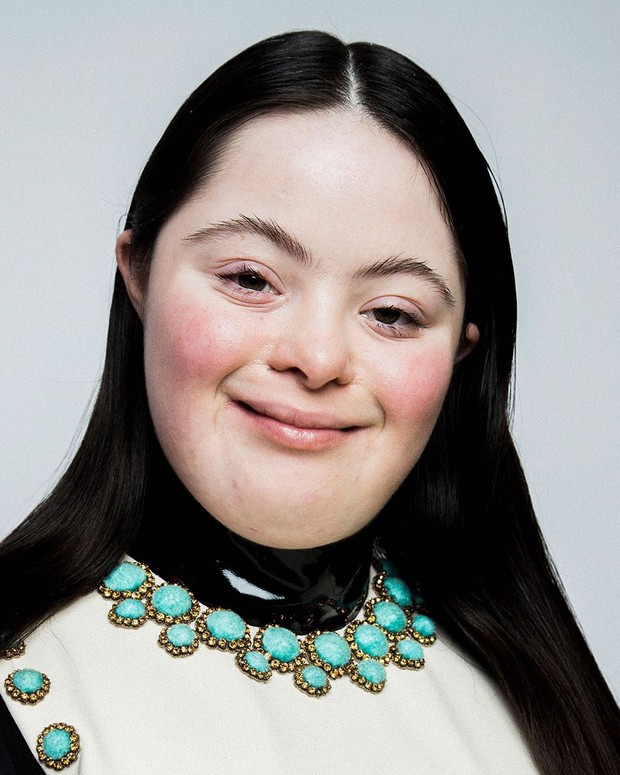 Ellie Goldstein, gadis down syndrome yang jadi model Gucci Beauty.