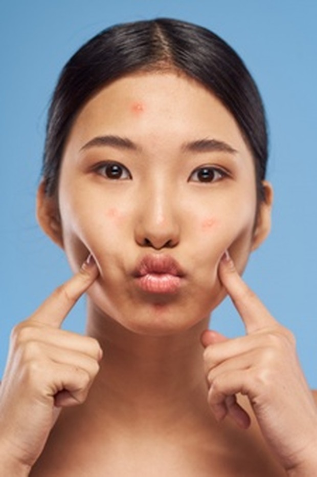 Menyamarkan Jerawat/Freepik.com menyamarkan jerawat