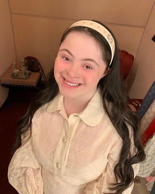 Ellie Goldstein, gadis down syndrome yang jadi model Gucci Beauty.