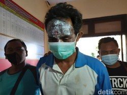 Lukai Wajah Sendiri, Dukun Cabul Masukkan Telur ke Kemaluan Dibawa ke RS