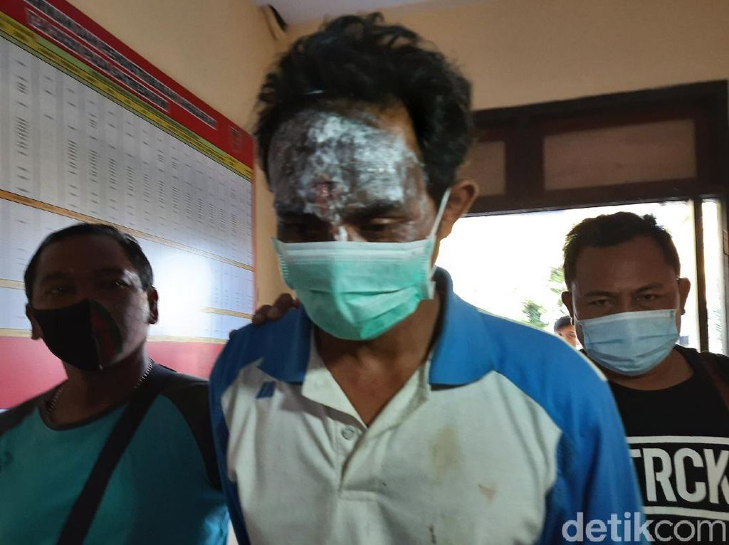 Lukai Wajah Sendiri, Dukun Cabul Masukkan Telur ke Kemaluan Dibawa ke RS Lukai Wajah Sendiri, Dukun Cabul Masukkan Telur ke Kemaluan Dibawa ke RS