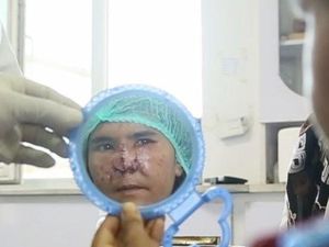 Kisah Wanita Afghanistan Dipotong Hidungnya oleh Suami karena Cemburu