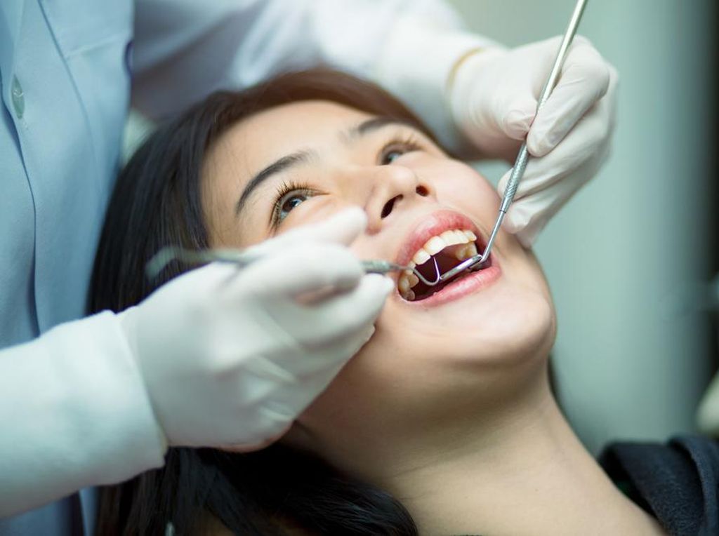 Nggak Cuma Bisa Bersihkan Karang Gigi, Ini Manfaat Lain dari Scaling
