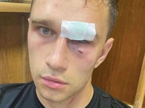 Wasit korban Roman Shirokov