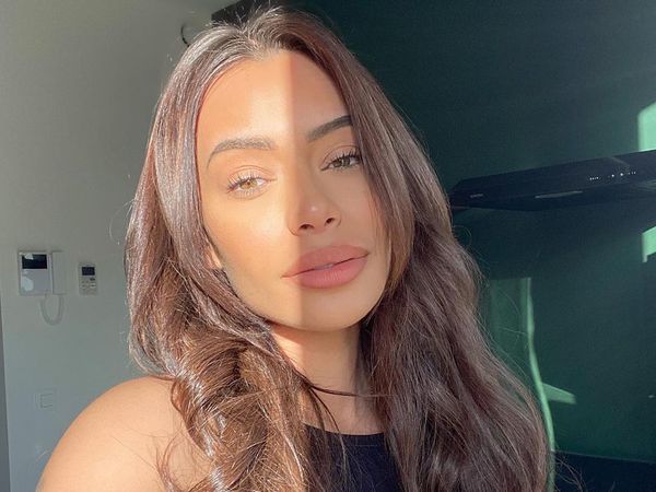 Foto: Penampakan Wajah Babak Belur Bintang Reality Show Cantik yang Dianiaya