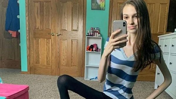 Foto Editan Konyol Demi Eksis di Medsos